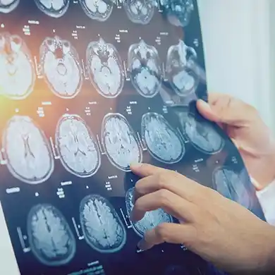 Brain Injury Image